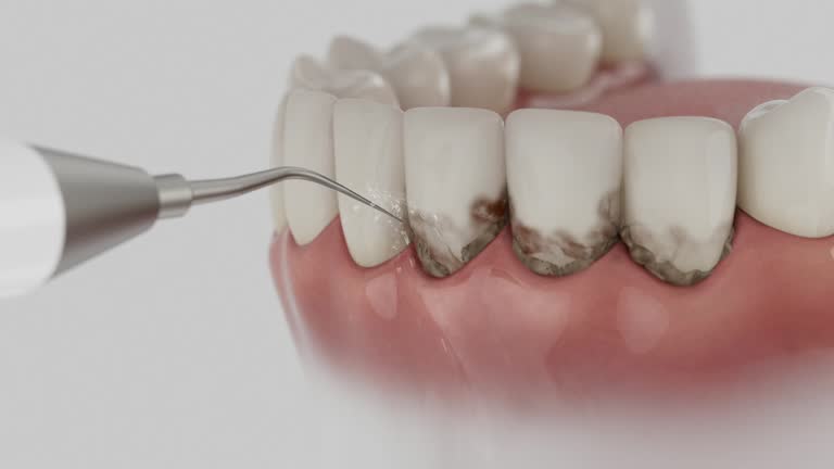 Reliable Dental contractor in Signal Hill, CA by Dentist Open Now